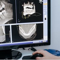 Screening by Intra Oral Camera